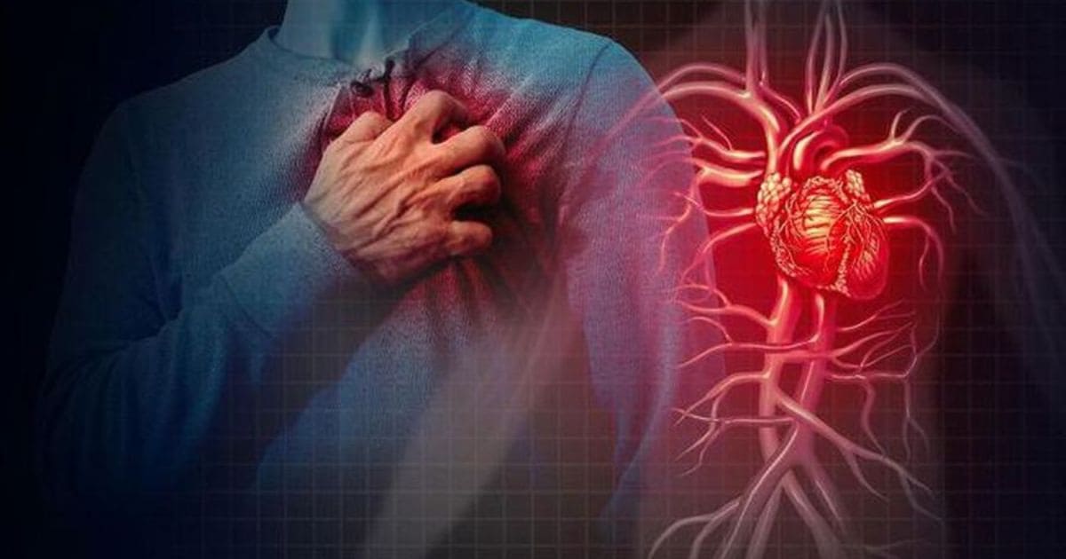 Cardiologist Reveals Cause of Sudden Death During Exercise
